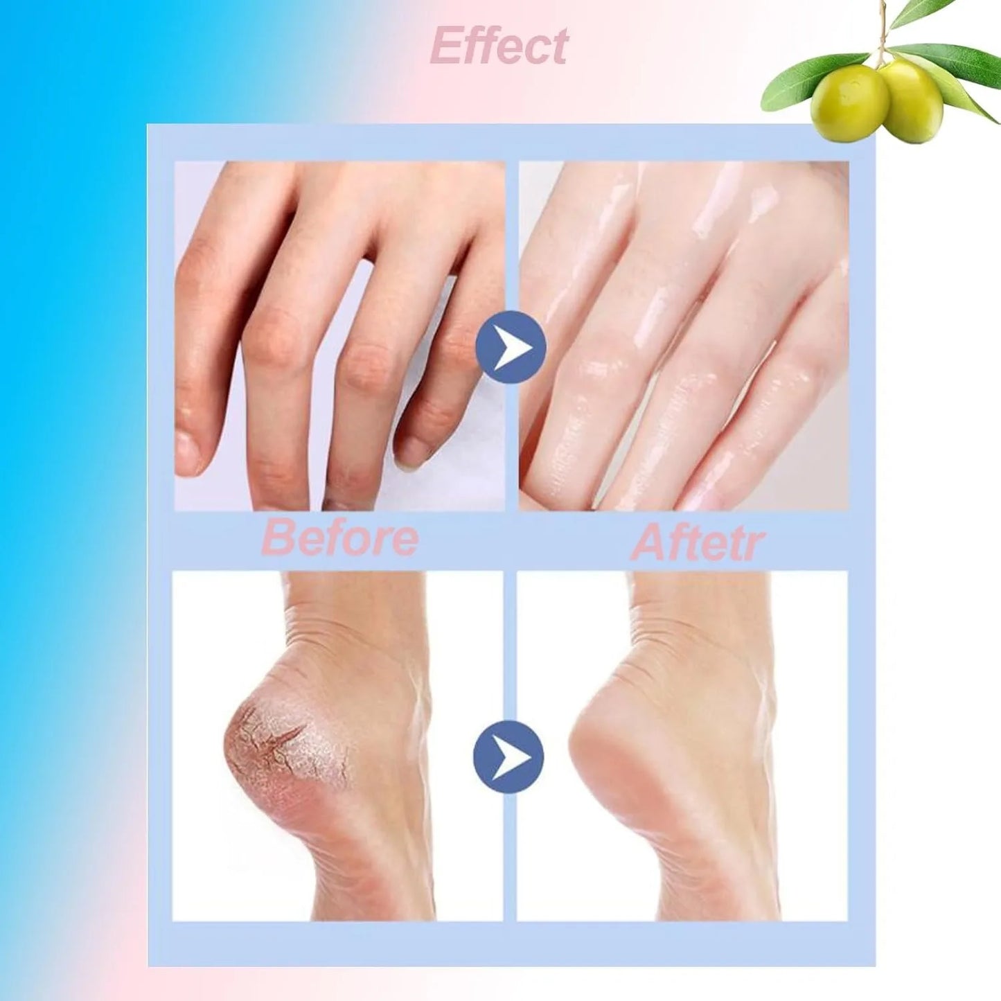 Cracked Heel Repair Stick Moisturizing Foot Care Treatment Hydrating Anti Crack Balm for Dry Feet Heels Skin