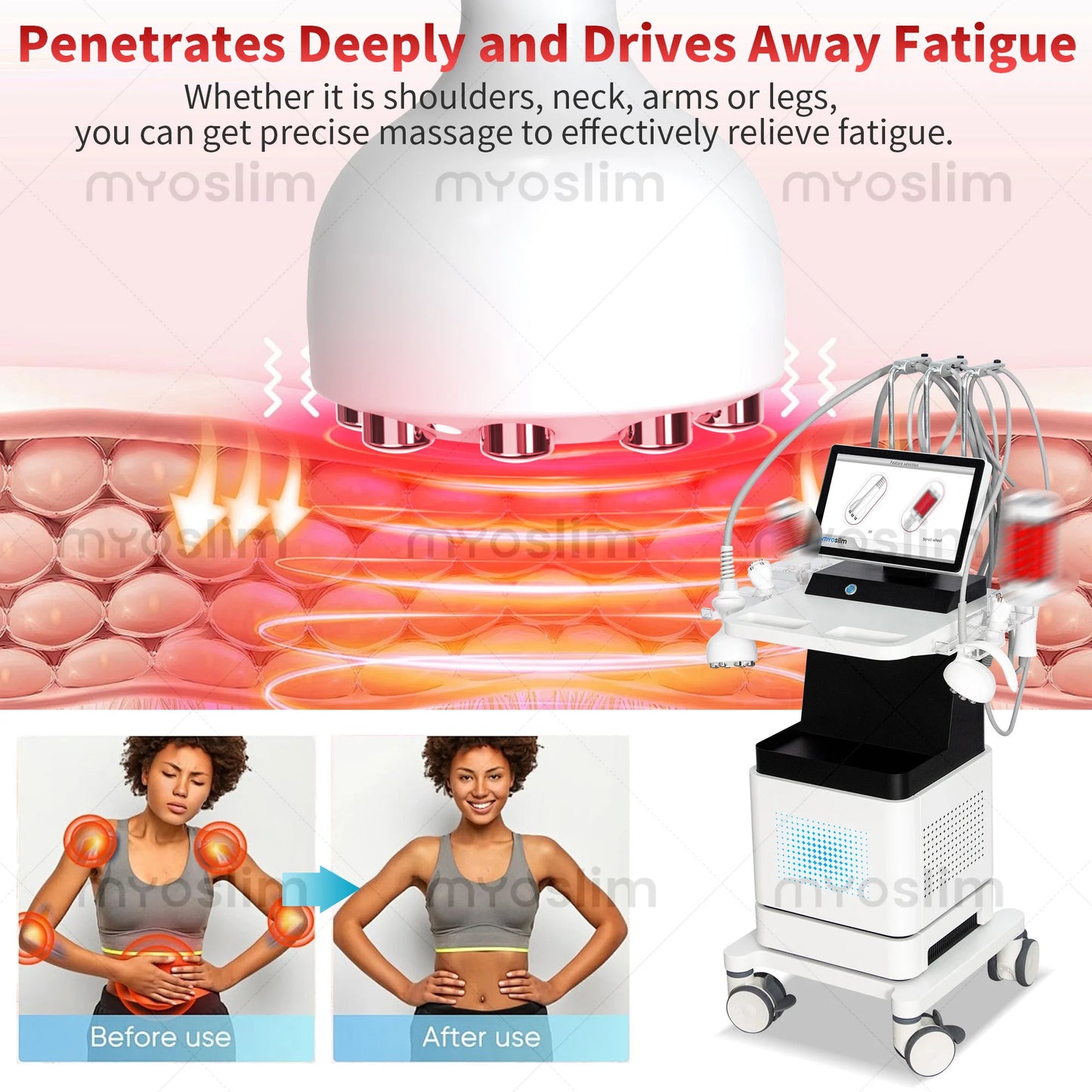Professional 4D RF Body Sculpting Machine With Vacuum Roller For Skin Tightening And Cellulite Reduction Beauty Salon Equipment