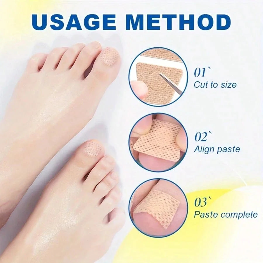 32Pcs Toenail Fungus Patch Waterproof Nail Repair Patches Nail Ingrown Correction Sticker Discolored Damaged Nail Foot Care Too